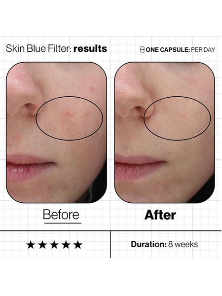 Advanced Nutrition Programme Skin Blue Filter