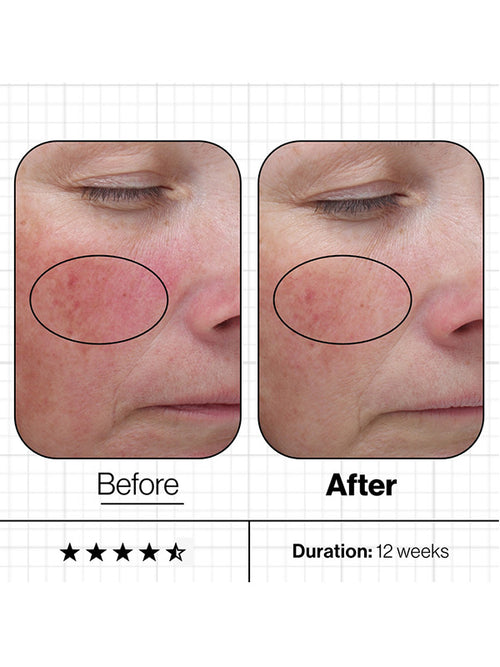 Advanced Nutrition Programme Skin Even IQ exp 07.25