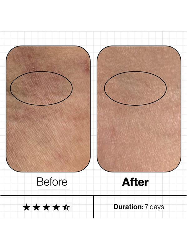 Advanced Nutrition Programme Skin Moisture IQ