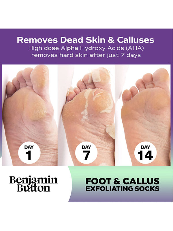 Benjamin Button Foot & Callus Exfoliating Socks (5pk)