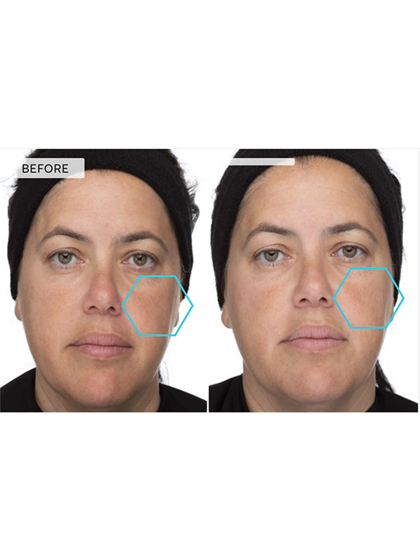 DermaQuest B5 Hydrating Serum (29.6ml)