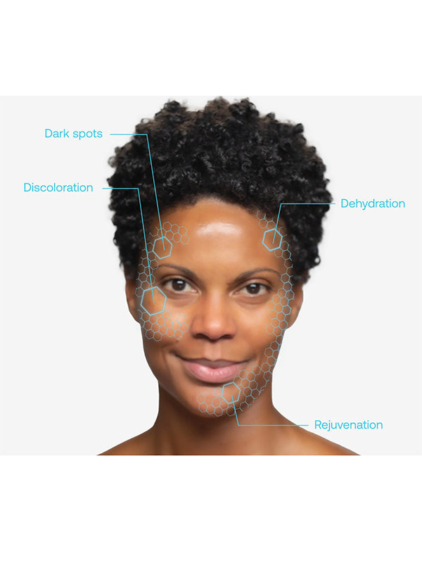 DermaQuest B5 Hydrating Serum (29.6ml)