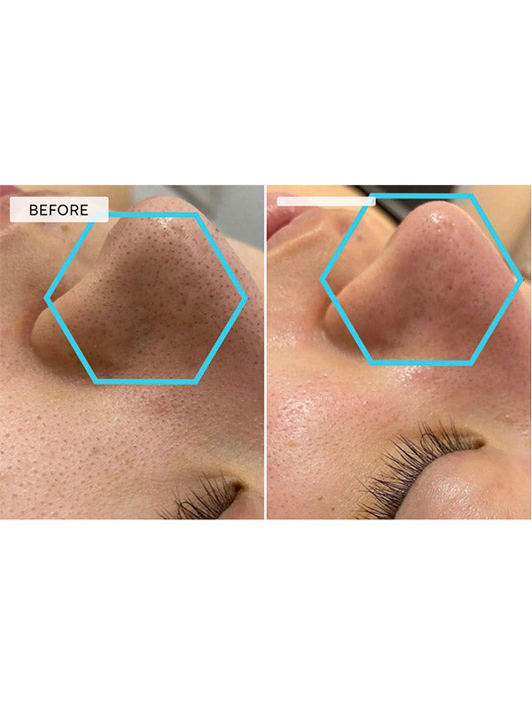 DermaQuest Mini Pumpkin Mask