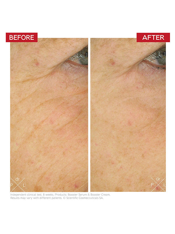 Dr. Levy Intense Stem Cell Booster Cream (50ml)