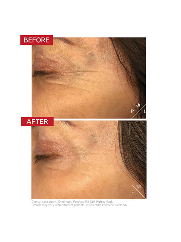 Dr. Levy R3 Cell Matrix Mask (50ml)