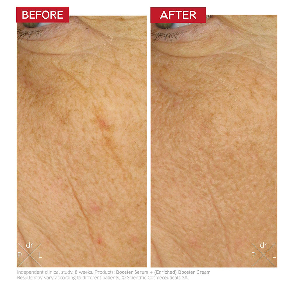 Dr. Levy Intense Stem Cell Enriched Booster Cream (50ml)