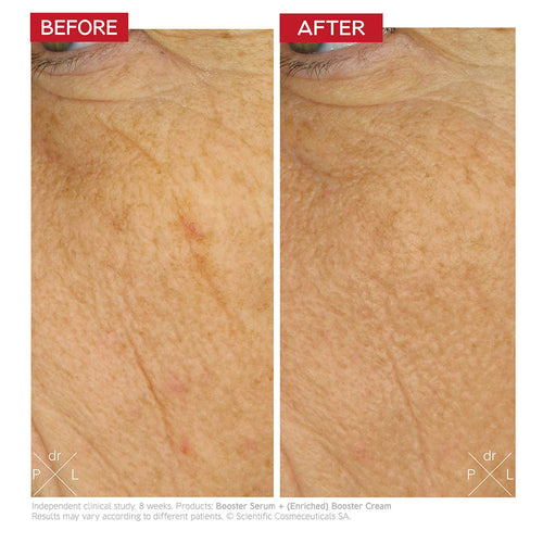 Dr. Levy Intense Stem Cell Enriched Booster Cream (50ml)