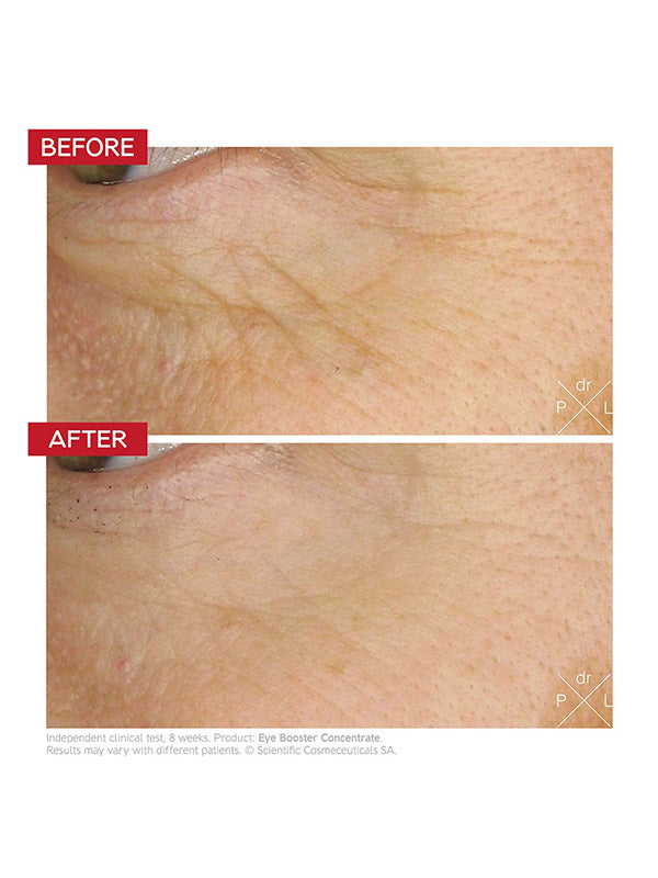 Dr. Levy Intense Stem Cell Eye Booster Concentrate (15ml)