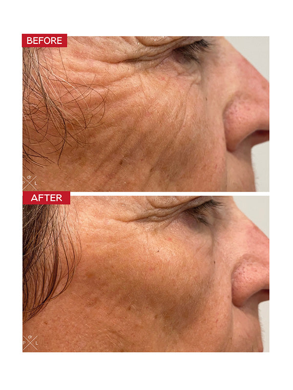 Dr. Levy The Pro Contour