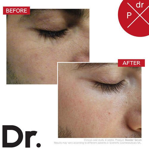 Dr. Levy Intense Stem Cell Booster Serum (15ml) (Unbox)