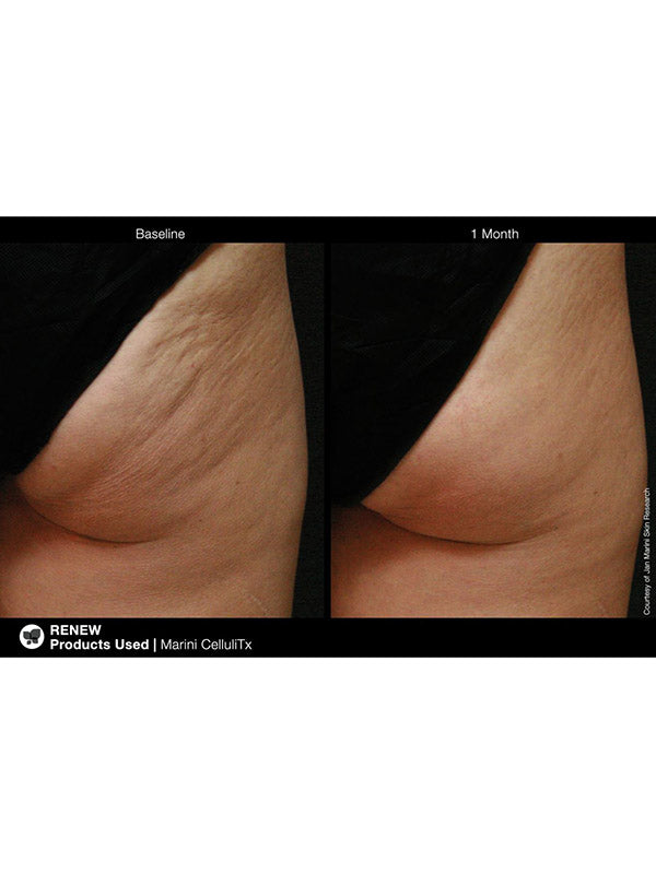 Jan Marini Marini CelluliTx Cellulite Cream (114g)