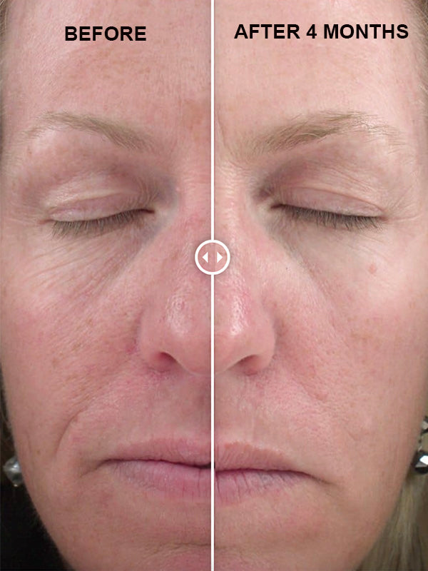 Jan Marini Age Intervention Face Cream (28g) (unbox)