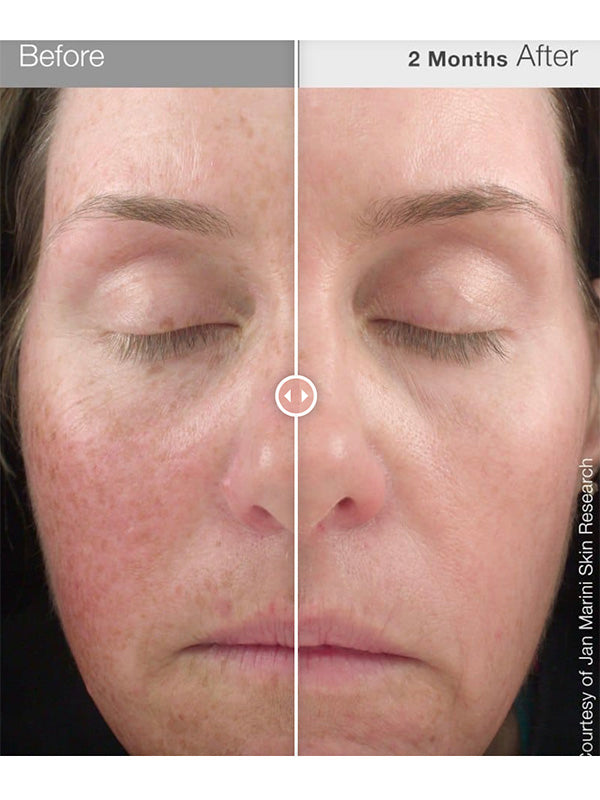 Jan Marini Luminate Face Lotion MD (30ml) Unbox