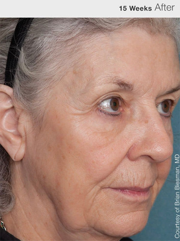 Jan Marini Physical Protectant Untinted SPF30 (57g)