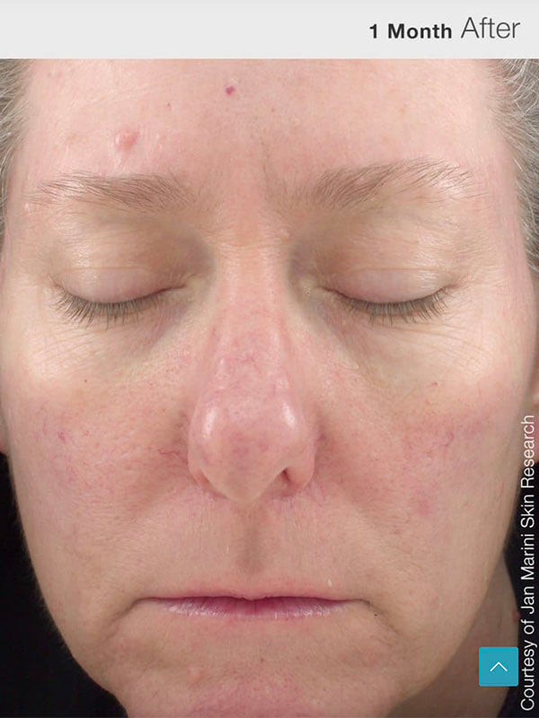 Jan Marini Rosalieve (30ml)