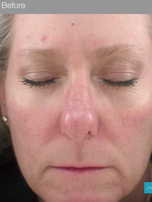 Jan Marini Rosalieve (30ml)