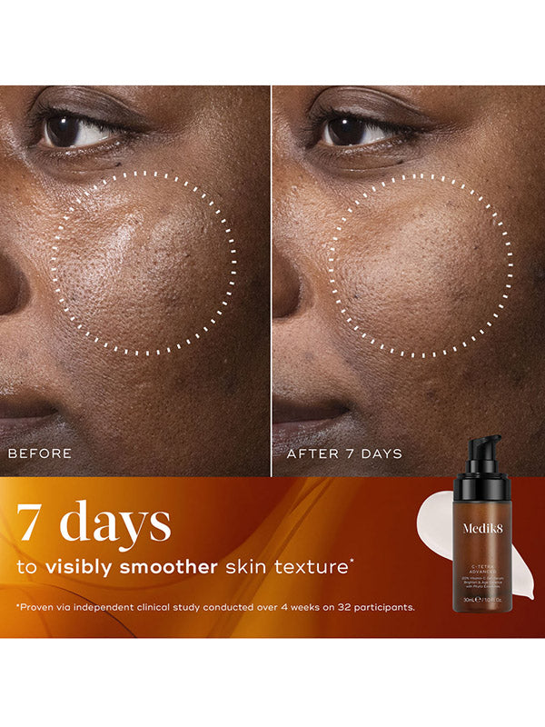 Medik8 C Tetra Advanced (30ml)