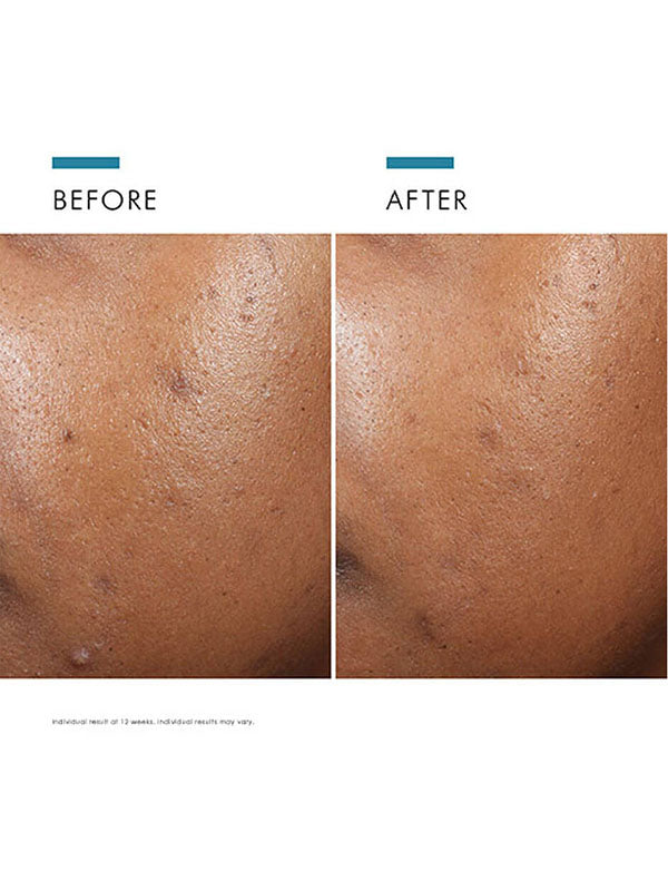 SkinCeuticals Phyto A+ Brightening Treatment (30ml)