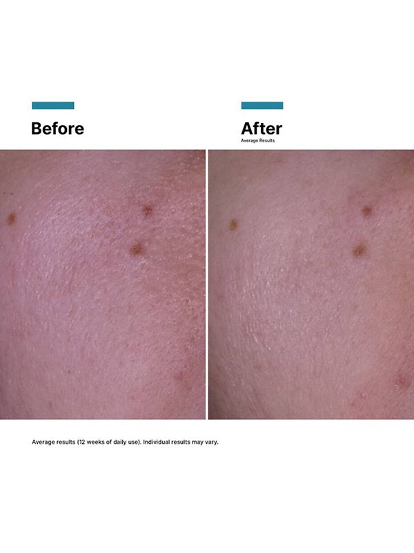 SkinCeuticals P-Tiox Cream (48ml)