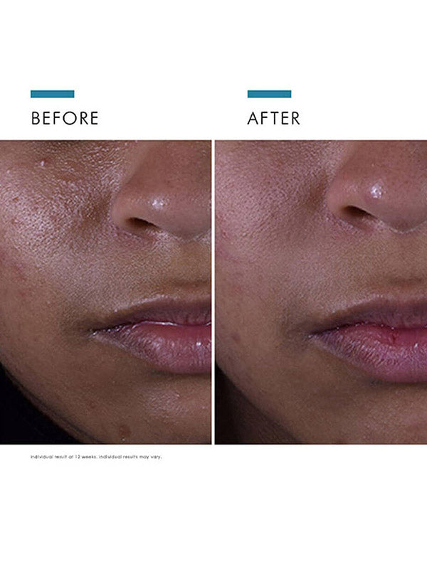 SkinCeuticals Silymarin CF (30ml)