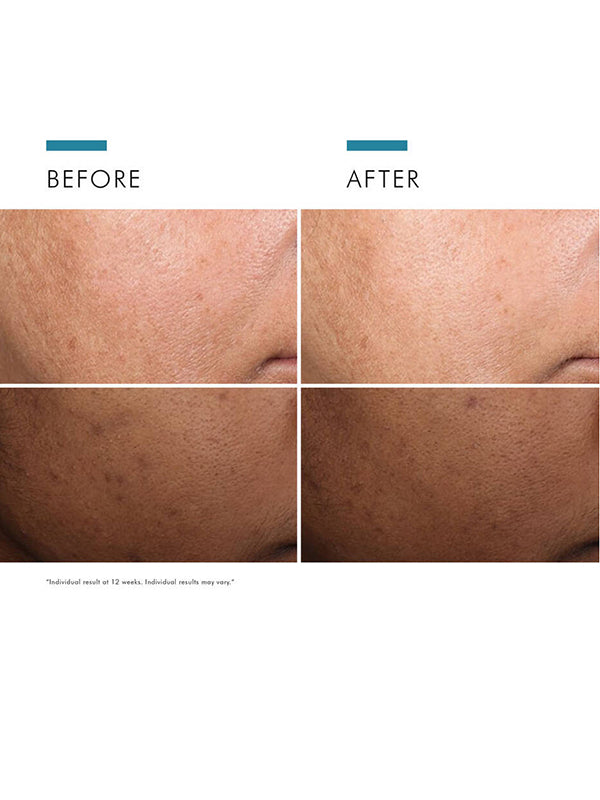 SkinCeuticals Discoloration Defense Serum (30ml)
