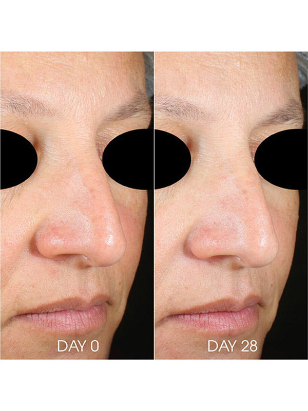 Teoxane RHA Hydra Mask (50ml)