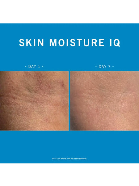 Advanced Nutrition Programme Skin Moisture IQ
